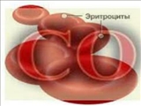 مسمومیت با مونوکسید کربن، 6 شهروند تبریزی را راهی بیمارستان کرد